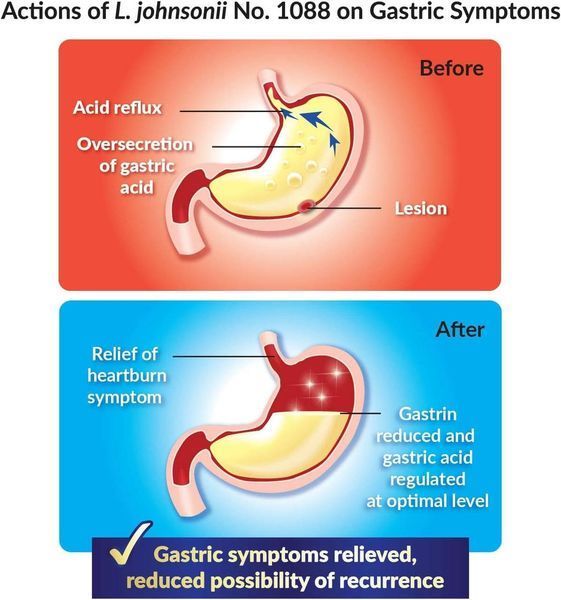 Естественная защита от расстройства желудка LABO Nutrition GASTRICEL 30 пакетов 4384306544 фото